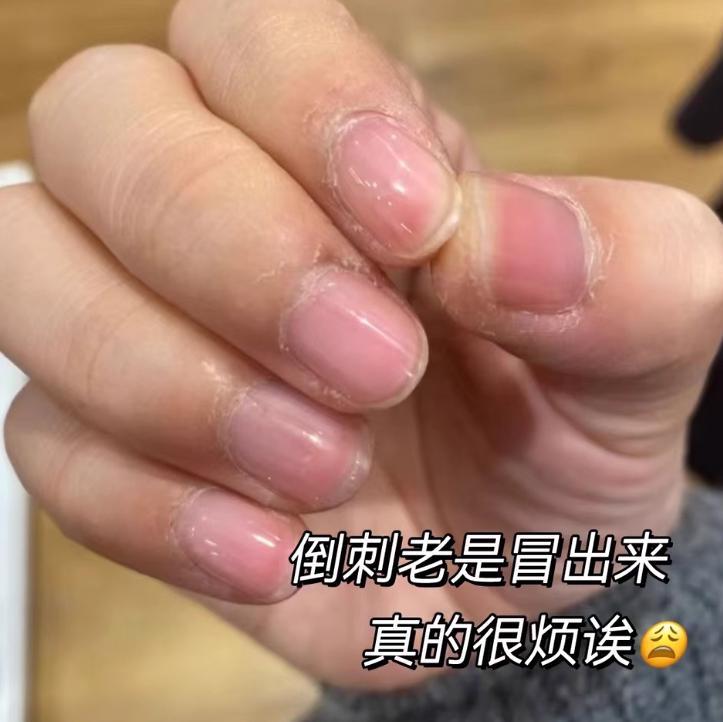 护手霜配方技术深度解析：为何这款“六边形战士”能通吃八大肤质？